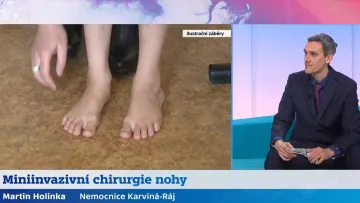 Estetická chirurgie nohy