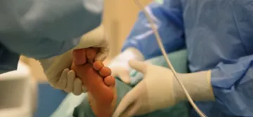 Estetická chirurgia nohy - operácia