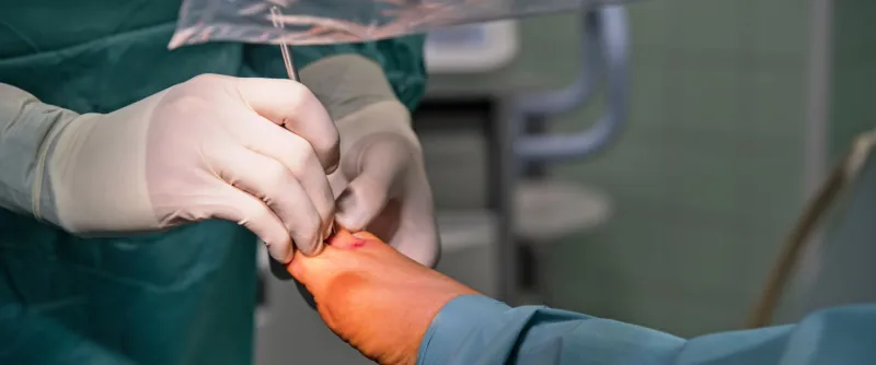 Estetická a mini invazivna chirurgia nohy