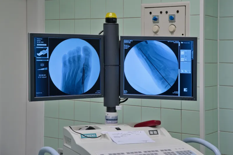 Estetická chirurgie nohy