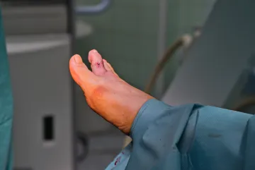 Estetická chirurgie nohy